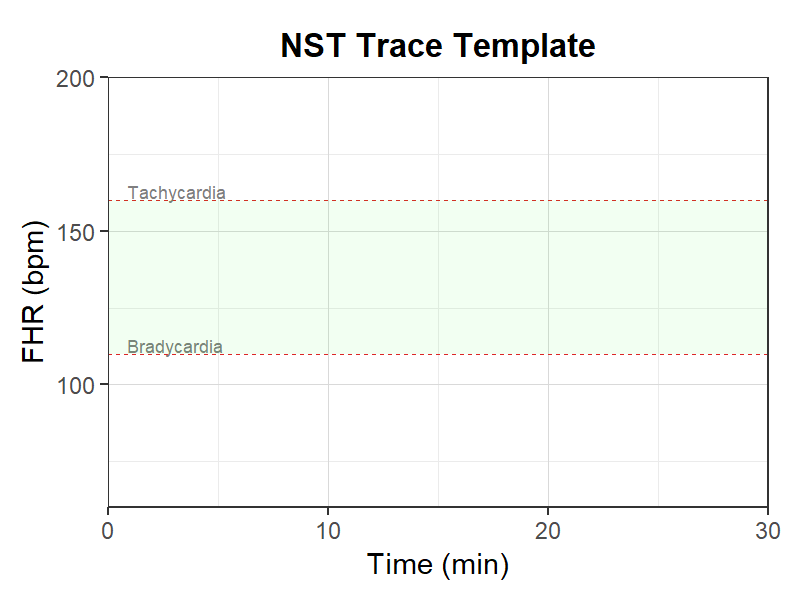 NSTトレーステンプレート